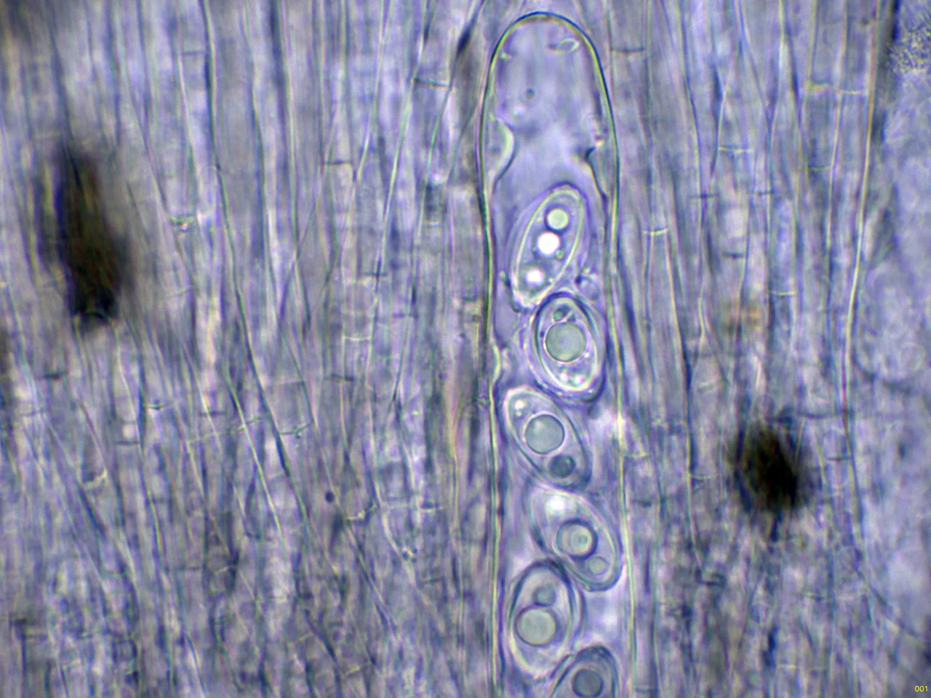 Microscopía de Discina melaleuca - 10 - Asco agua -001